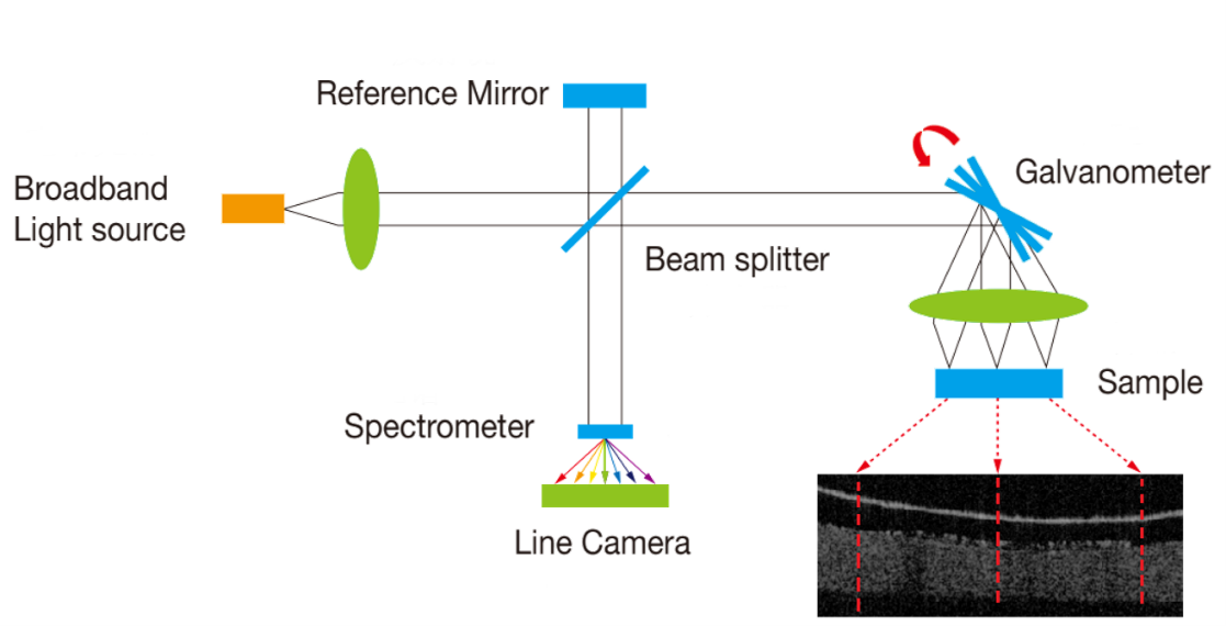 Optical Coherence Tomography Device